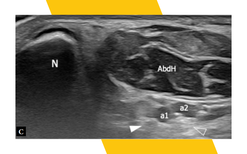 5. Musculatura intrinseca pie ecografia tempo formacion.png